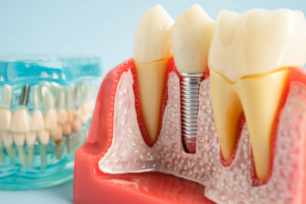 Best Periodontal (Gum) Disease Treatment  in Brices Creek, NC